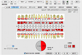 ムシ歯チェック