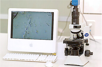 顕微鏡で細菌チェック