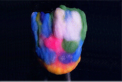 歯科技工士が製作する多色築盛